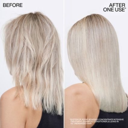 Beforeafter1